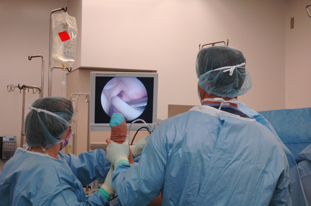 Arthroscopic Surgery for Shoulder Impingement